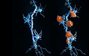 دانشمندان کشف کردند که بیماری اماس ممکن است دو زیرگروه مجزا داشته باشد دانشمندان کشف کردند که بیماری اماس ممکن است دو زیرگروه مجزا داشته باشد